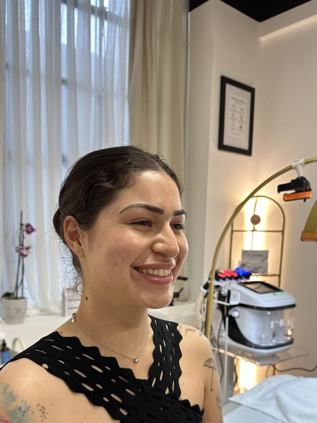 A Melatone client photographed beside the SMARTDiode laser system at the Battersea clinic, laser hair removal for every skin tone