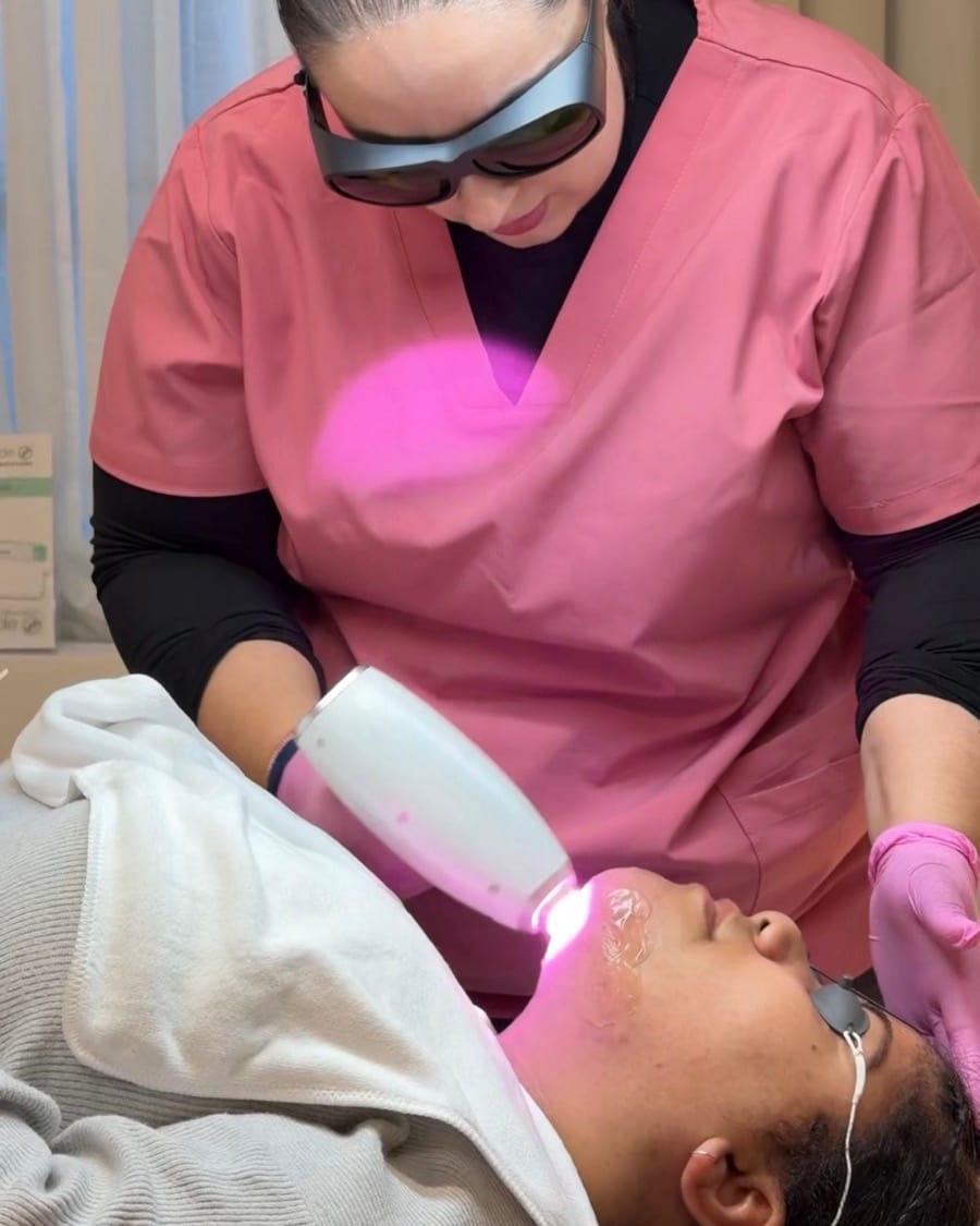 Laser treatment on Fitzpatrick V to VI skin at Melatone Skin Clinic Battersea, handpiece calibrated to the patient's skin type