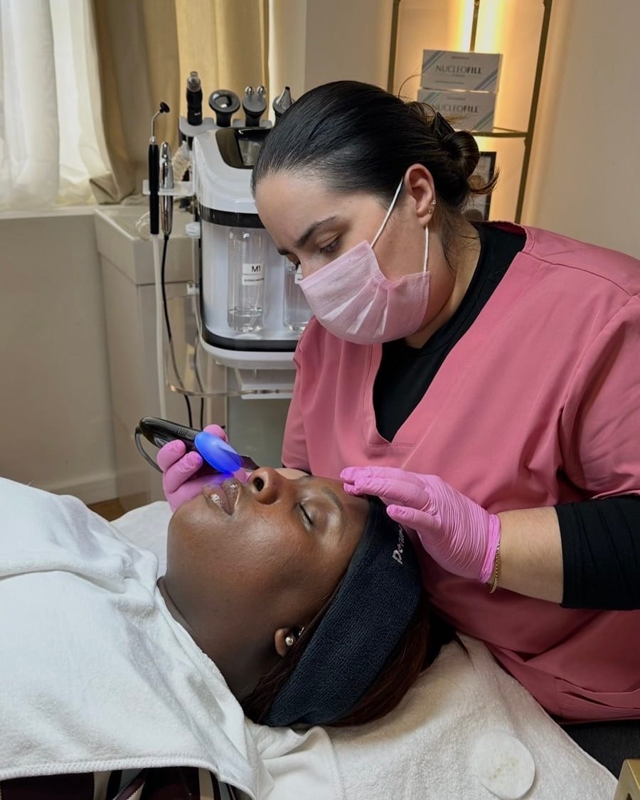 Skin treatment on a Skin of Colour client at Melatone Skin Clinic Battersea, settings chosen for the patient's Fitzpatrick type
