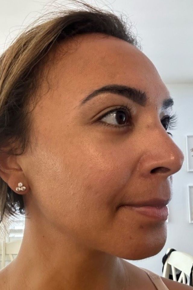 Skin after using ESK skincare, example 2