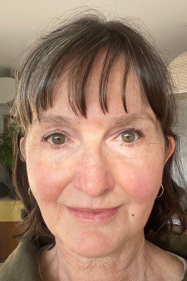 Skin after using ESK skincare, example 9