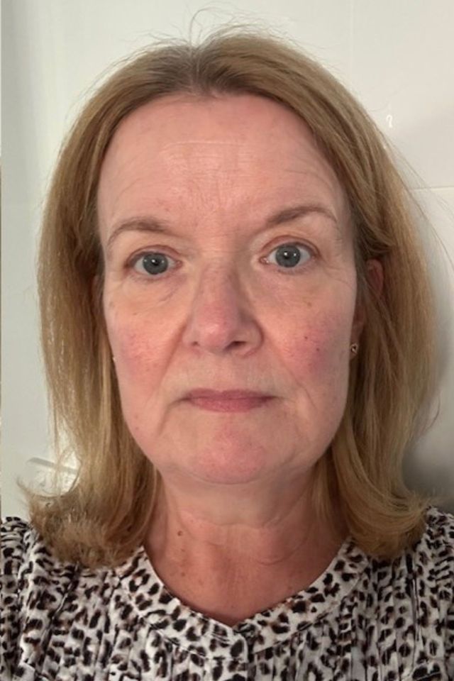 Skin after using ESK skincare, example 10