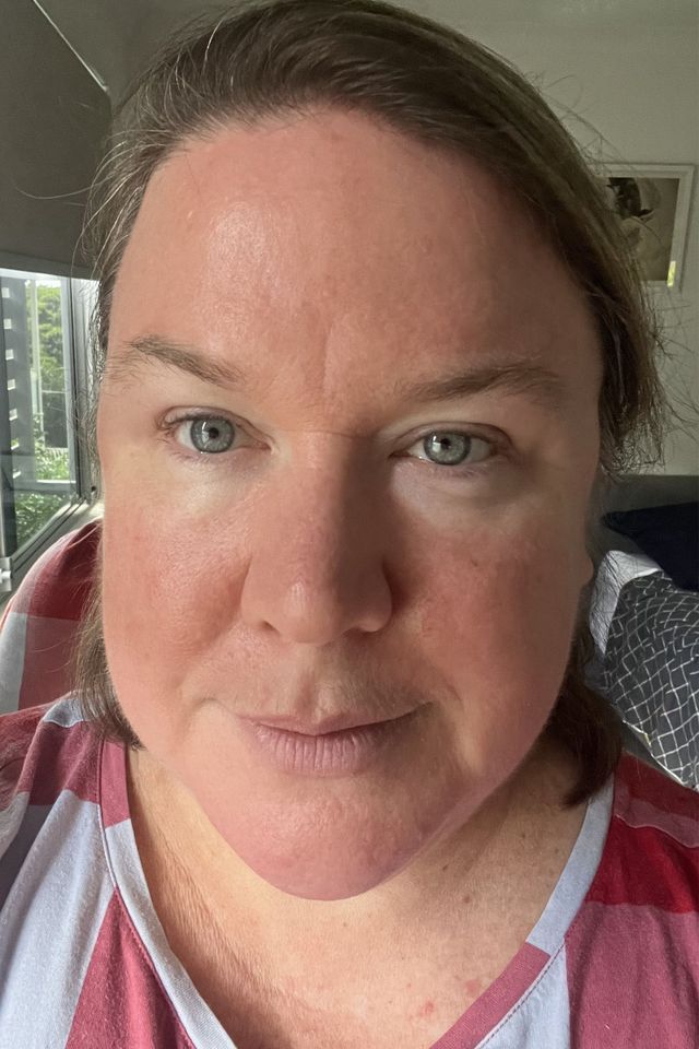 Skin after using ESK skincare, example 12