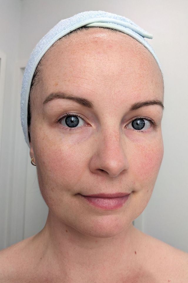Skin after using ESK skincare, example 15