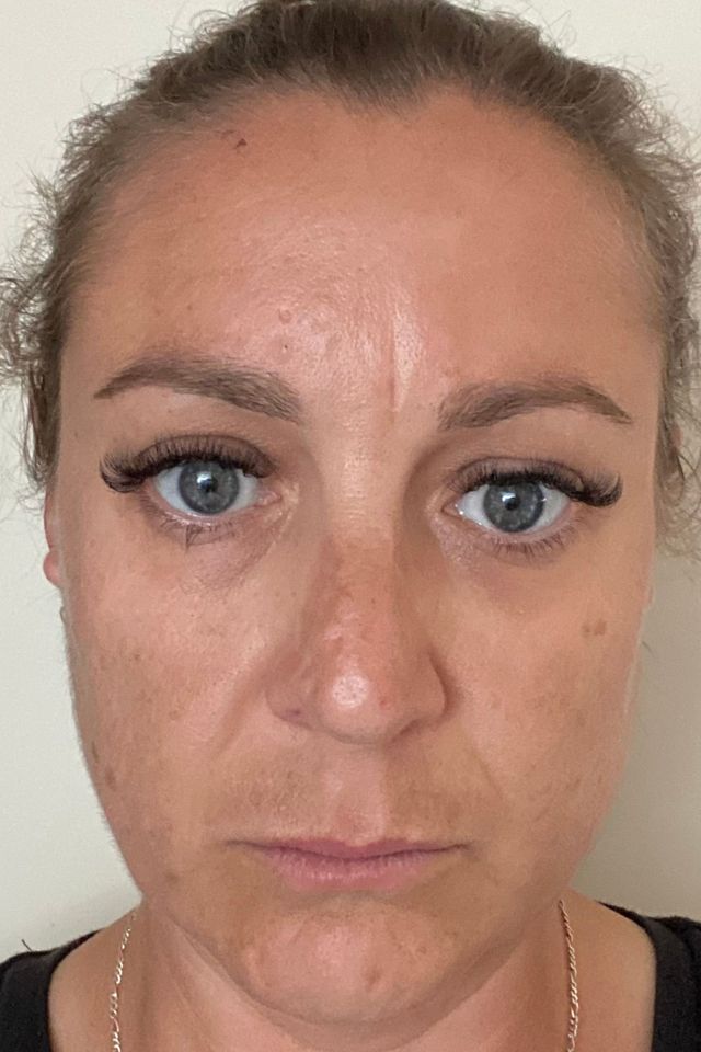 Skin after using ESK skincare, example 16