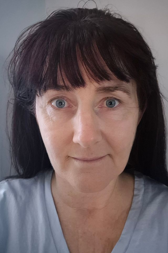 Skin after using ESK skincare, example 19