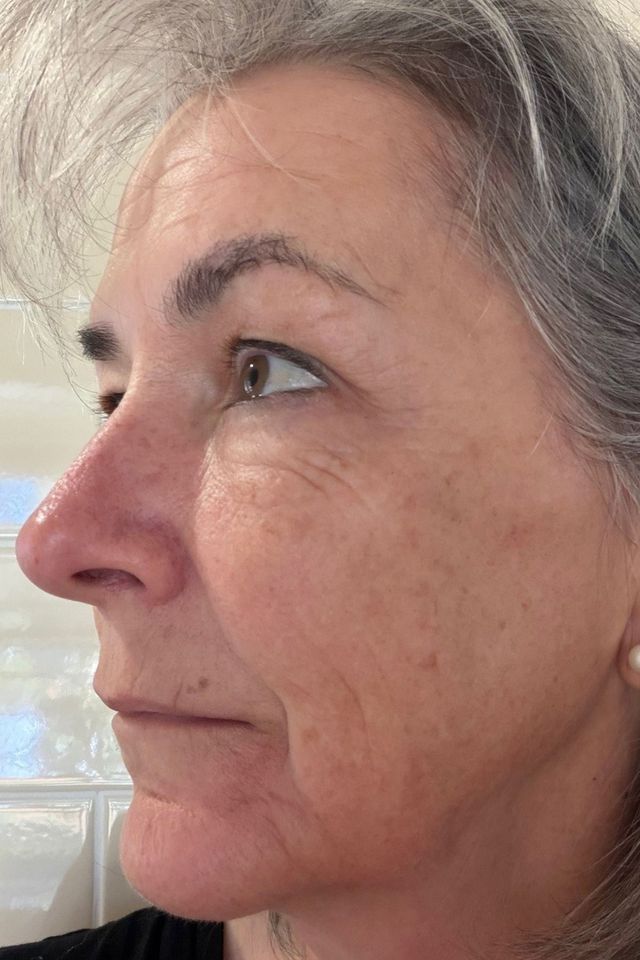 Skin after using ESK skincare, example 20