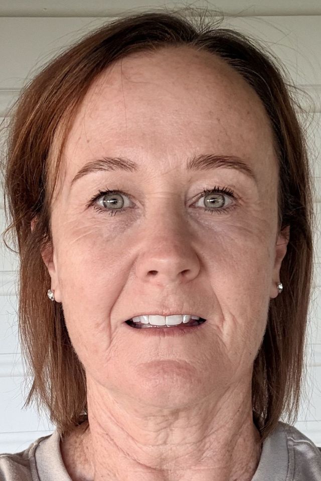 Skin after using ESK skincare, example 21
