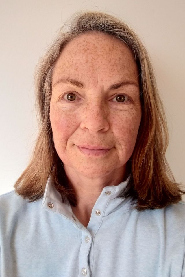 Skin before using ESK skincare, example 22