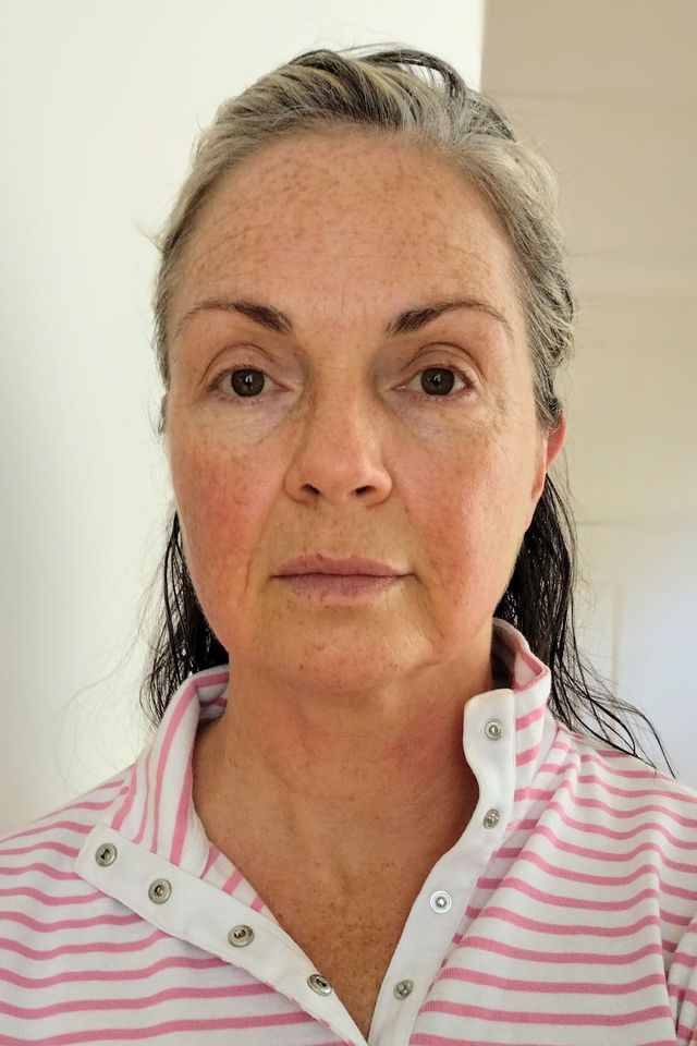 Skin after using ESK skincare, example 22