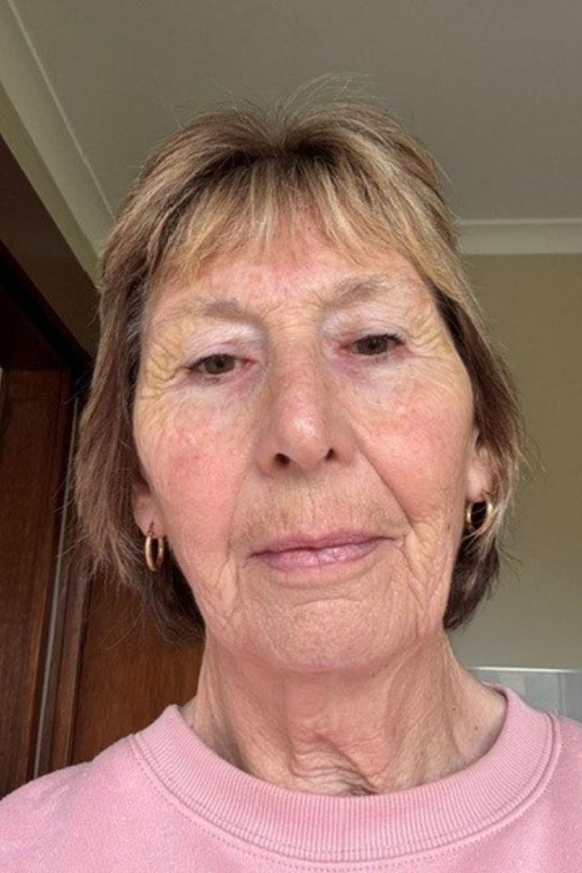 Skin after using ESK skincare, example 23