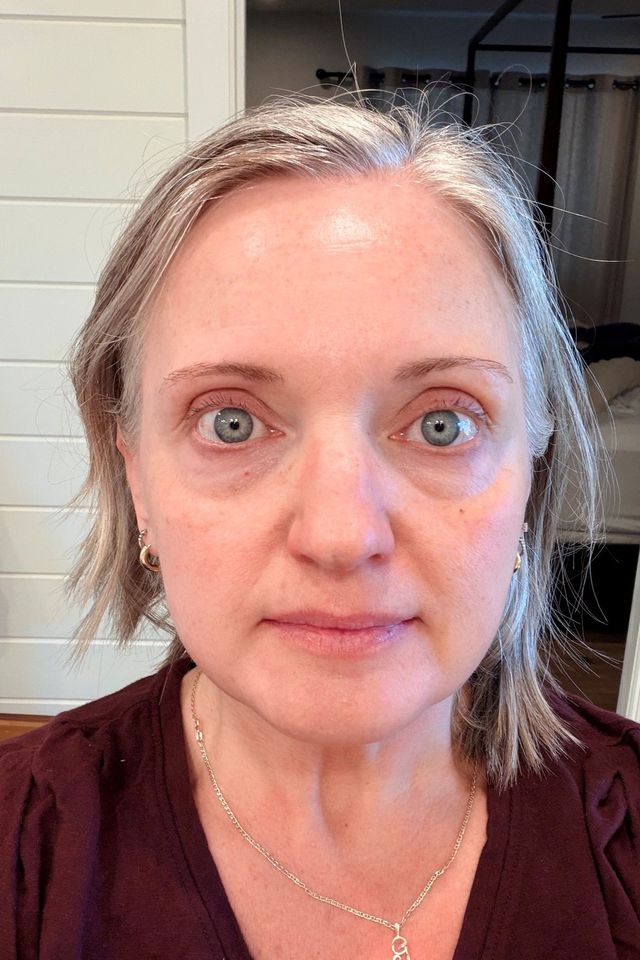 Skin after using ESK skincare, example 24