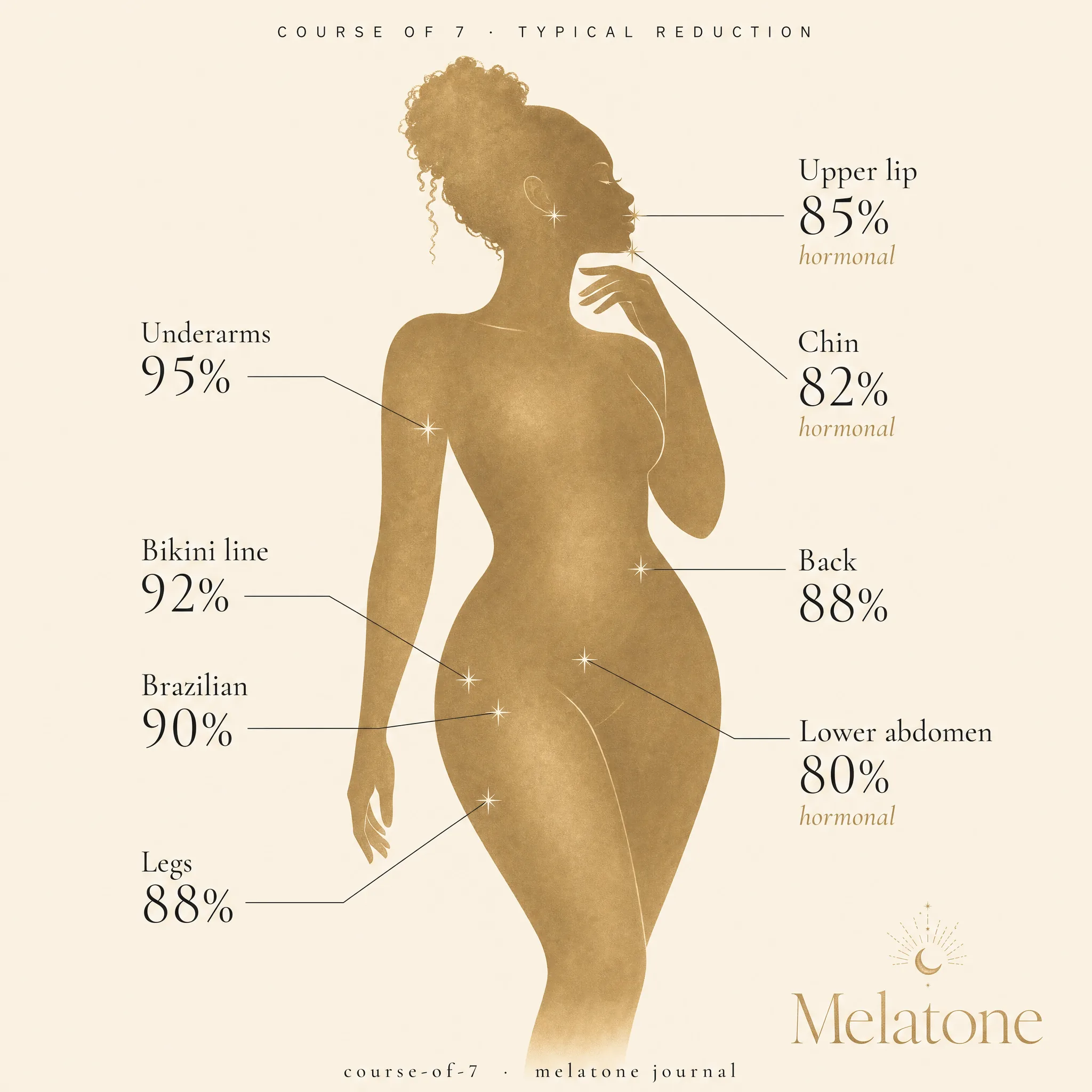 Editorial body silhouette showing typical hair reduction by area after a course of 7: Underarms 95 percent, Bikini line 92 percent, Brazilian 90 percent, Legs 88 percent, Back 88 percent, Upper lip 85 percent hormonal, Chin 82 percent hormonal, Lower abdomen 80 percent hormonal